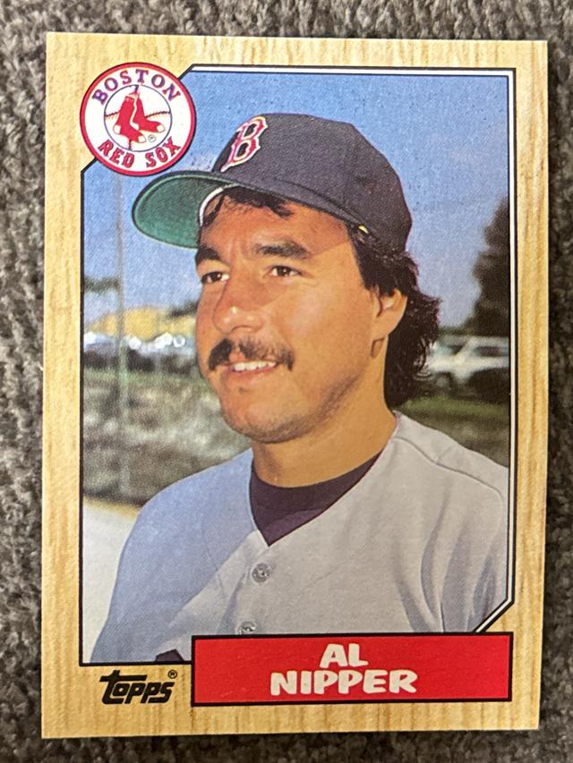 1987 Topps Al Nipper Base Set #617