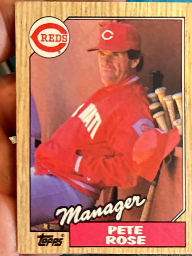 1987 Topps Pete Rose Base Set #393