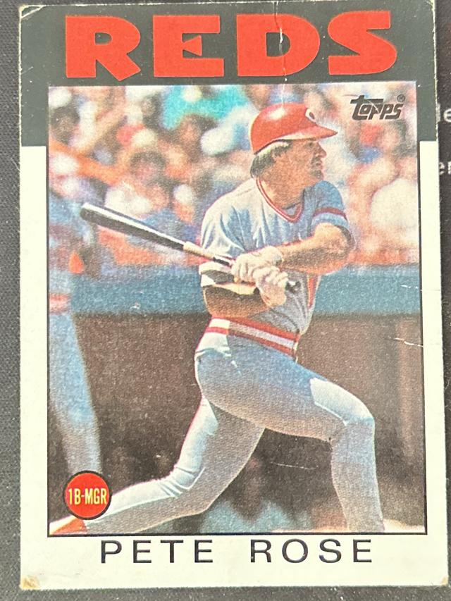 1986 Topps Pete Rose Base Set #1